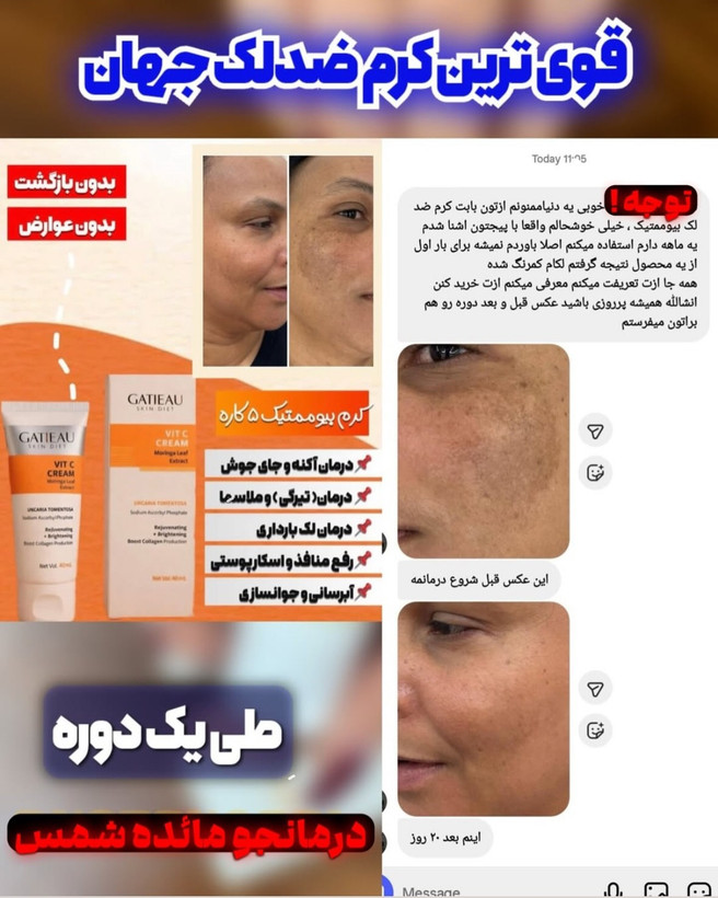 پک کرم بیوممتیک گاتیو + کرم ویتامین E ویتابلا اصل